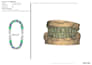 design all on x, all on 4 prosthesis using exocad